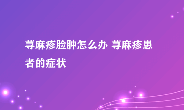 荨麻疹脸肿怎么办 荨麻疹患者的症状