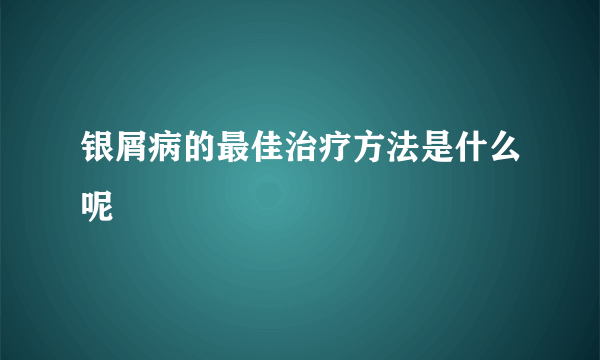 银屑病的最佳治疗方法是什么呢