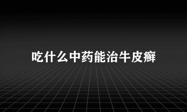 吃什么中药能治牛皮癣