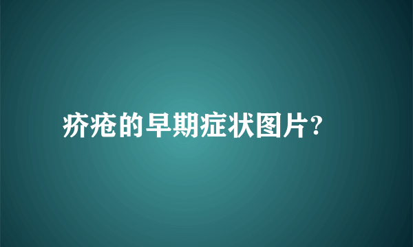 疥疮的早期症状图片?	