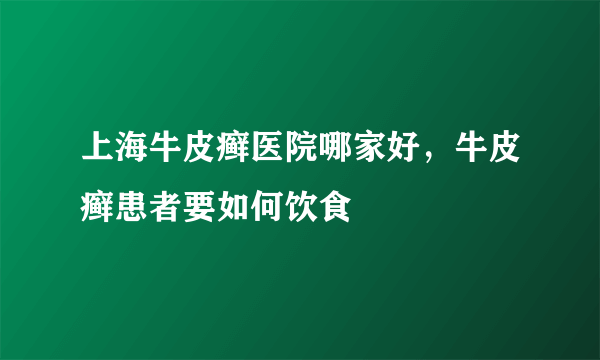 上海牛皮癣医院哪家好，牛皮癣患者要如何饮食