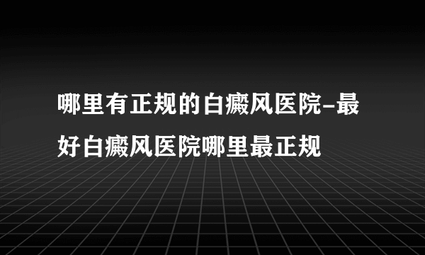 哪里有正规的白癜风医院-最好白癜风医院哪里最正规