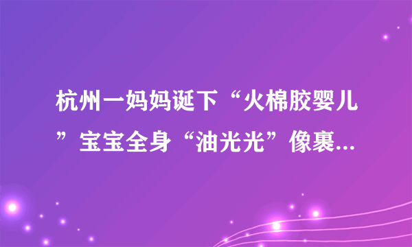 杭州一妈妈诞下“火棉胶婴儿”宝宝全身“油光光”像裹了一层羊皮纸!