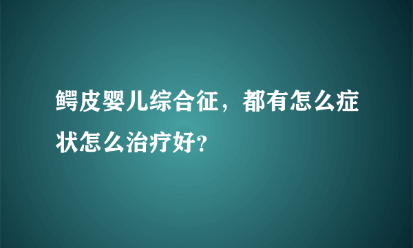 鳄皮婴儿综合征，都有怎么症状怎么治疗好？