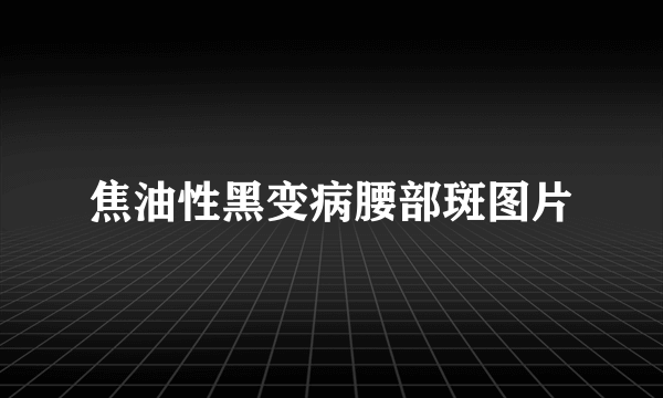 焦油性黑变病腰部斑图片