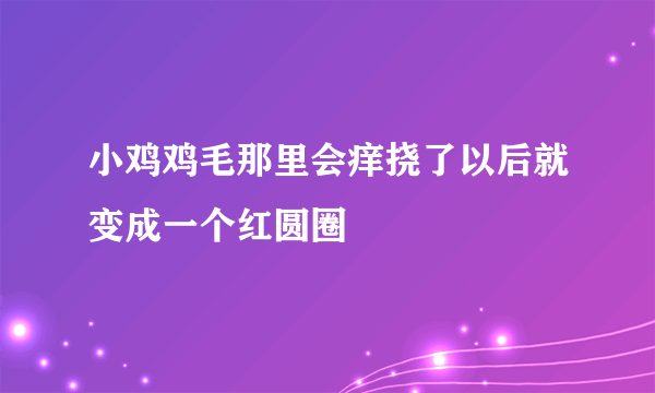 小鸡鸡毛那里会痒挠了以后就变成一个红圆圈