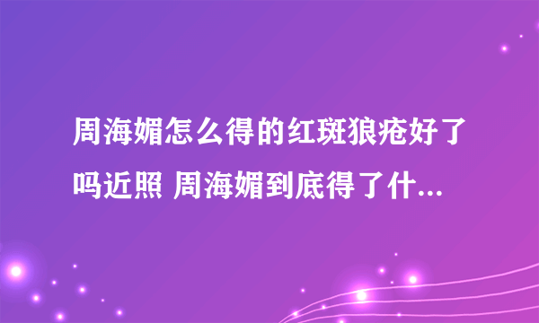 周海媚怎么得的红斑狼疮好了吗近照 周海媚到底得了什么病现状图