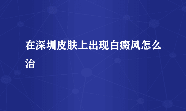 在深圳皮肤上出现白癜风怎么治