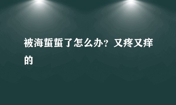 被海蜇蜇了怎么办？又疼又痒的