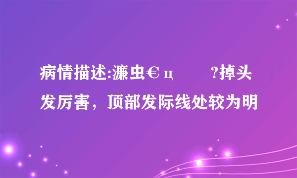 病情描述:濂虫€ц劚鍙?掉头发厉害，顶部发际线处较为明