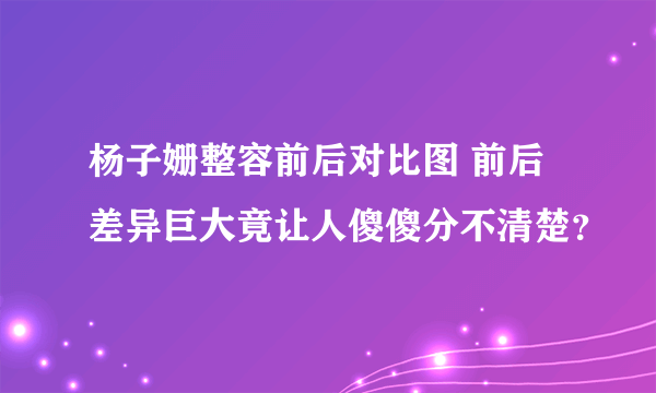 杨子姗整容前后对比图 前后差异巨大竟让人傻傻分不清楚？