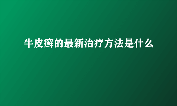 牛皮癣的最新治疗方法是什么