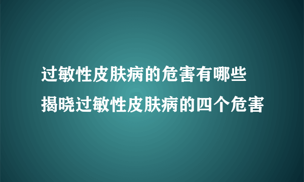 过敏性皮肤病的危害有哪些 揭晓过敏性皮肤病的四个危害