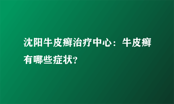 沈阳牛皮癣治疗中心：牛皮癣有哪些症状？