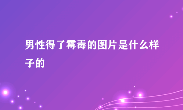 男性得了霉毒的图片是什么样子的