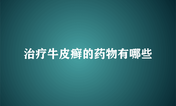 治疗牛皮癣的药物有哪些