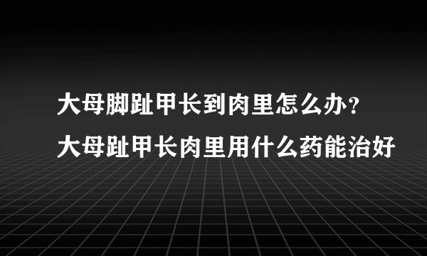 大母脚趾甲长到肉里怎么办？大母趾甲长肉里用什么药能治好