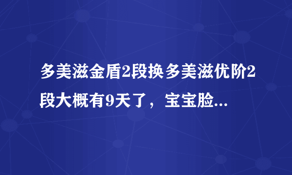 多美滋金盾2段换多美滋优阶2段大概有9天了，宝宝脸上一直出现湿疹怎么办？