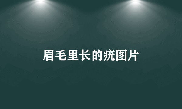 眉毛里长的疣图片