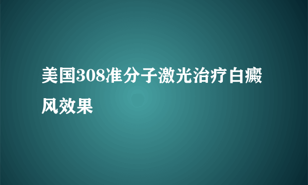 美国308准分子激光治疗白癜风效果