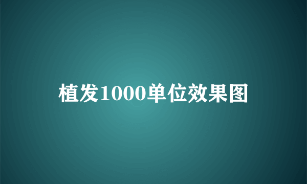 植发1000单位效果图