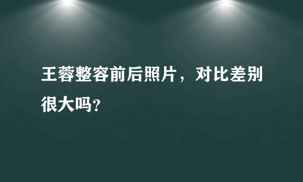 王蓉整容前后照片，对比差别很大吗？