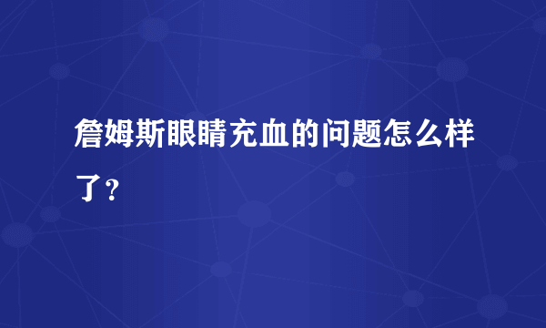 詹姆斯眼睛充血的问题怎么样了？