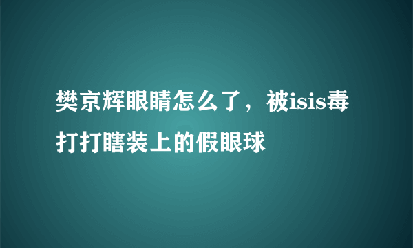 樊京辉眼睛怎么了，被isis毒打打瞎装上的假眼球