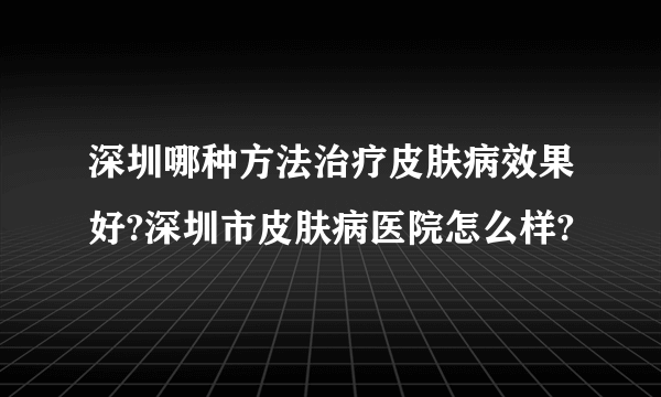 深圳哪种方法治疗皮肤病效果好?深圳市皮肤病医院怎么样?