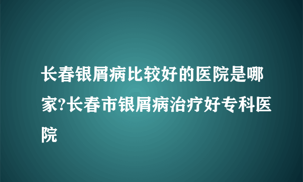 长春银屑病比较好的医院是哪家?长春市银屑病治疗好专科医院