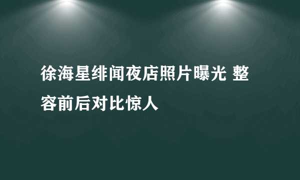 徐海星绯闻夜店照片曝光 整容前后对比惊人