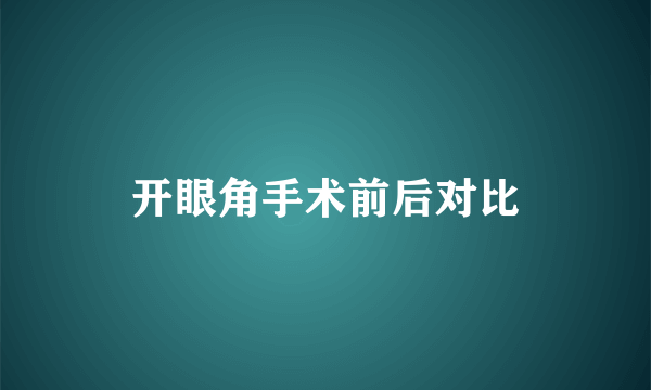 开眼角手术前后对比