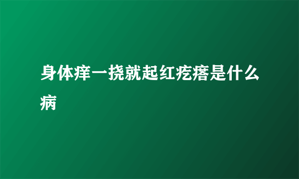 身体痒一挠就起红疙瘩是什么病