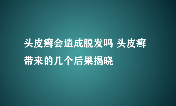 头皮癣会造成脱发吗 头皮癣带来的几个后果揭晓