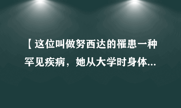 【这位叫做努西达的罹患一种罕见疾病，她从大学时身体就开始不断长出铁丝，甚至有的铁丝一夜之间还会长到