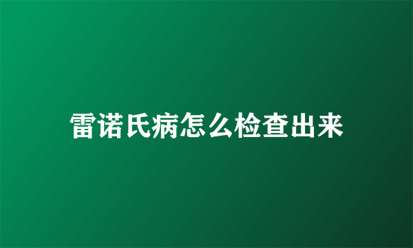 雷诺氏病怎么检查出来