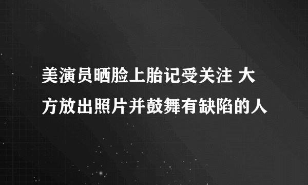 美演员晒脸上胎记受关注 大方放出照片并鼓舞有缺陷的人