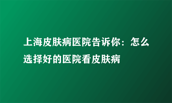 上海皮肤病医院告诉你：怎么选择好的医院看皮肤病