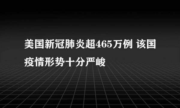 美国新冠肺炎超465万例 该国疫情形势十分严峻