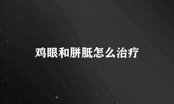 鸡眼和胼胝怎么治疗