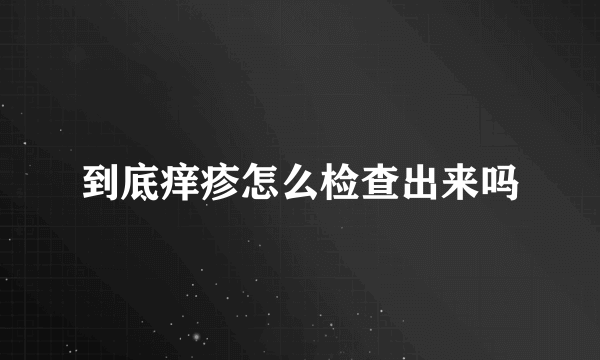 到底痒疹怎么检查出来吗