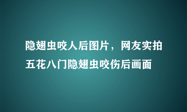 隐翅虫咬人后图片，网友实拍五花八门隐翅虫咬伤后画面