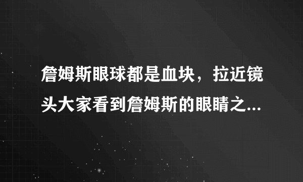 詹姆斯眼球都是血块，拉近镜头大家看到詹姆斯的眼睛之后，是什么感受？