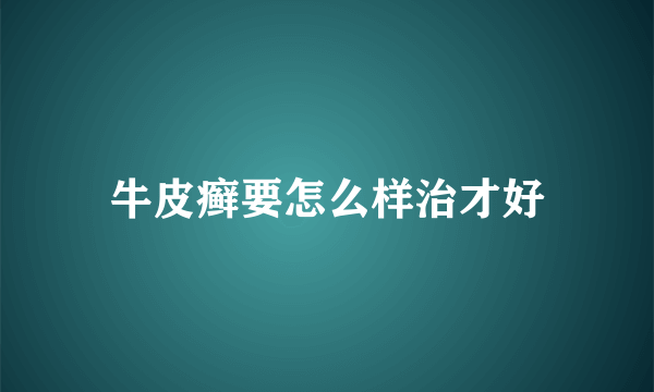 牛皮癣要怎么样治才好