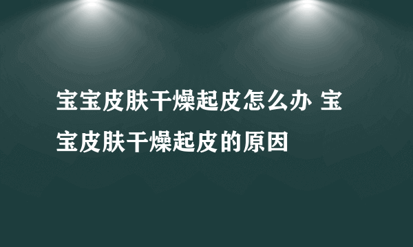 宝宝皮肤干燥起皮怎么办 宝宝皮肤干燥起皮的原因