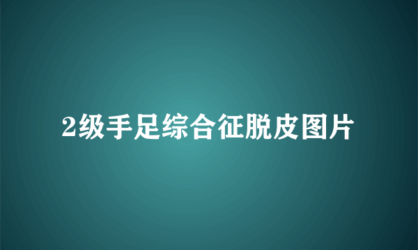 2级手足综合征脱皮图片