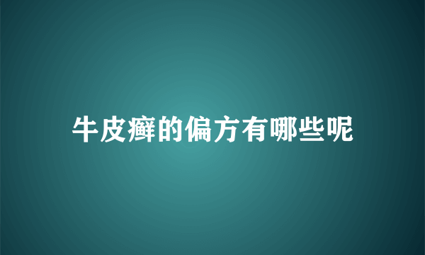 牛皮癣的偏方有哪些呢