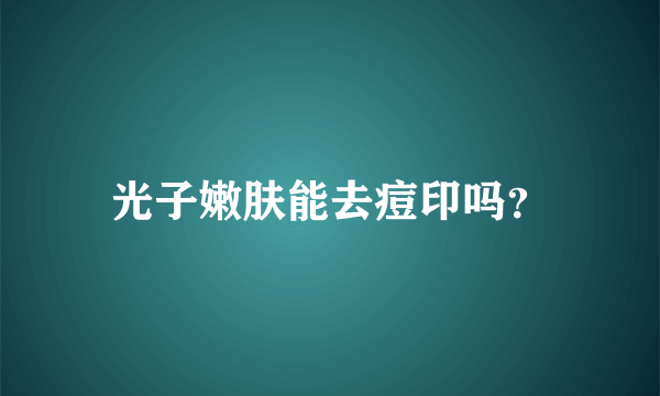 光子嫩肤能去痘印吗？