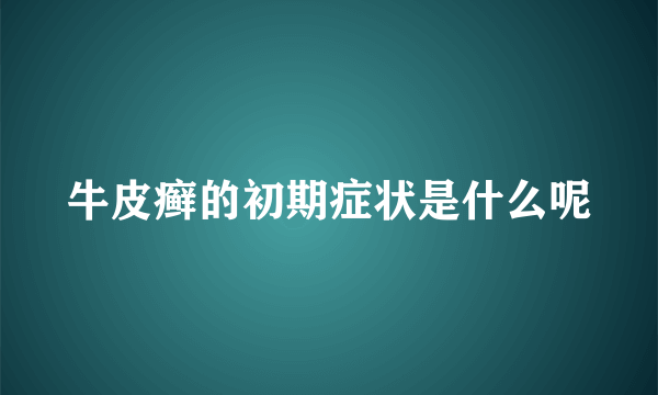 牛皮癣的初期症状是什么呢