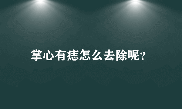 掌心有痣怎么去除呢？